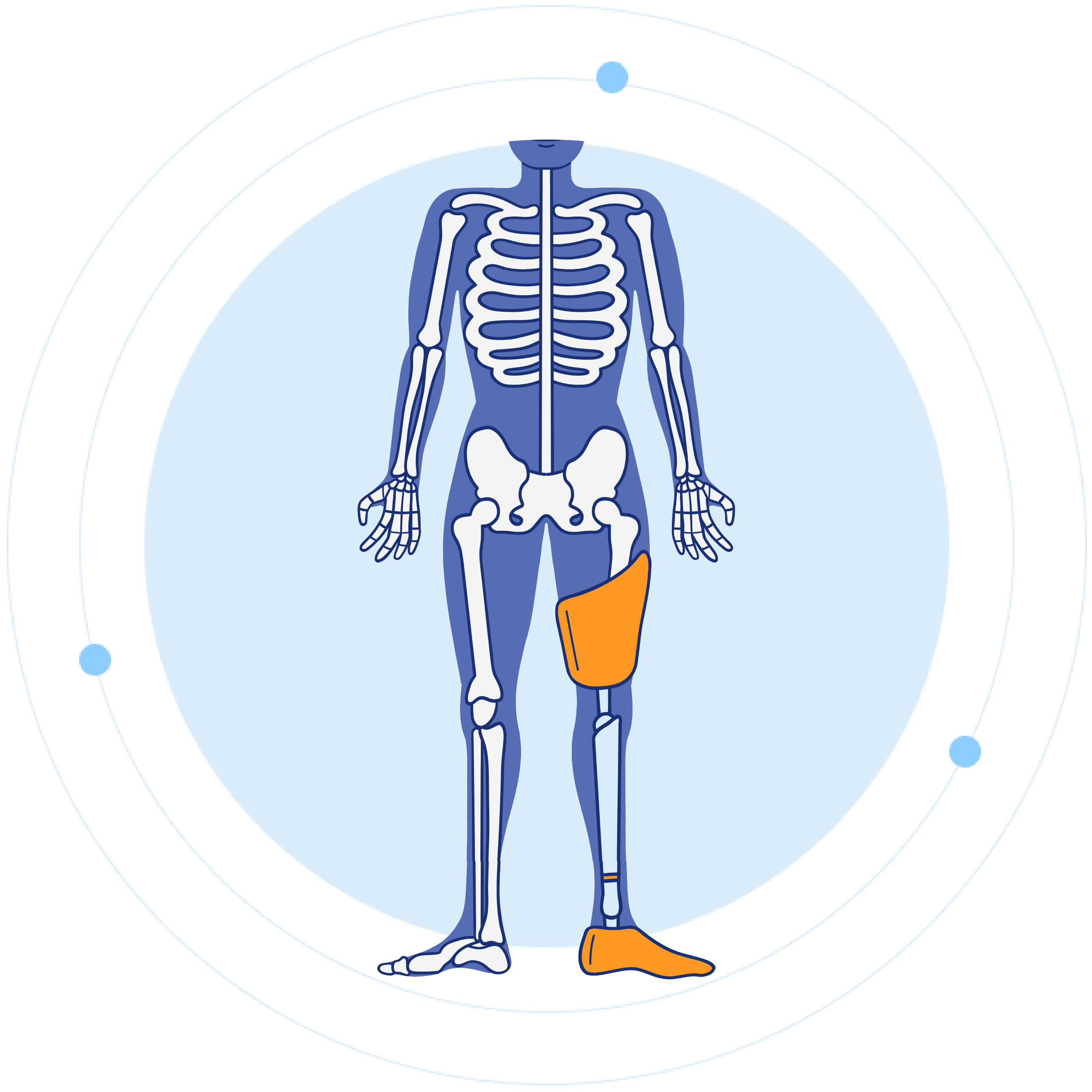 Above the Knee Prosthetics