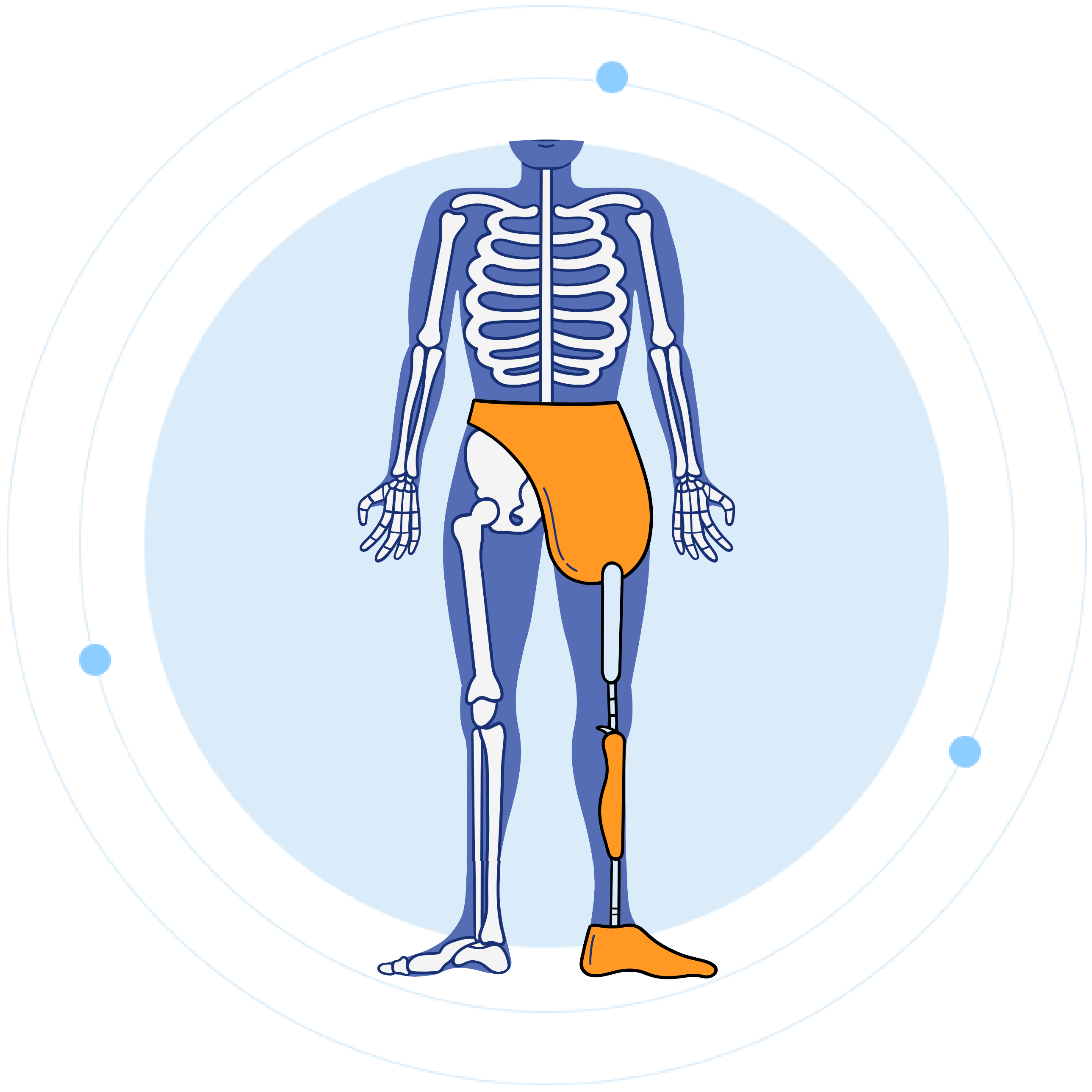 Hip Disarticulation Prosthetics