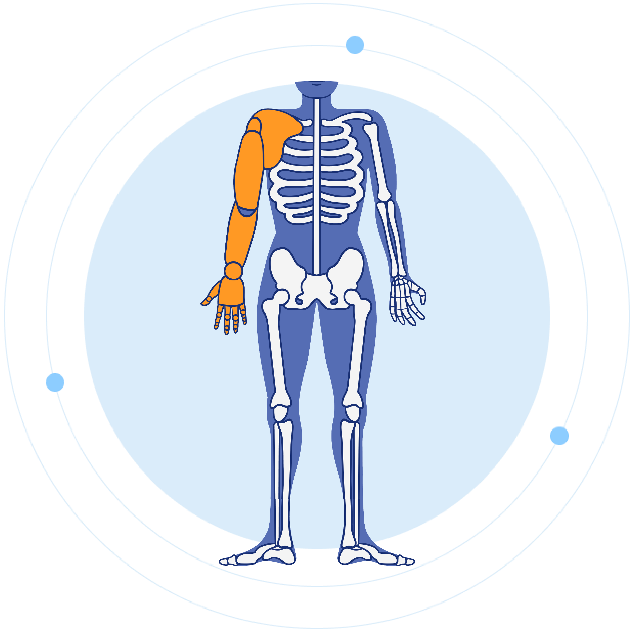 Through Shoulder Prosthetics