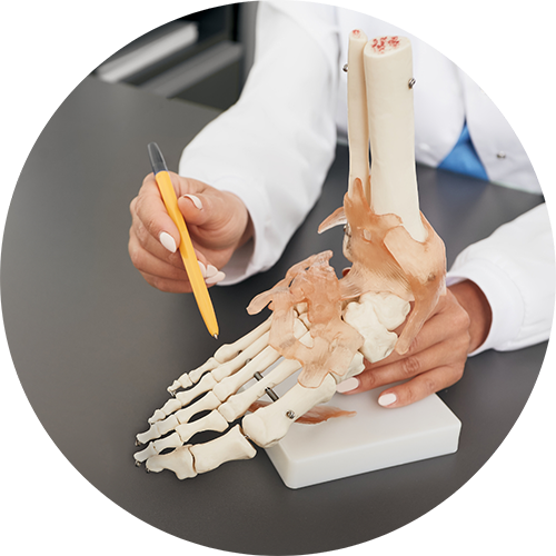 arthritis